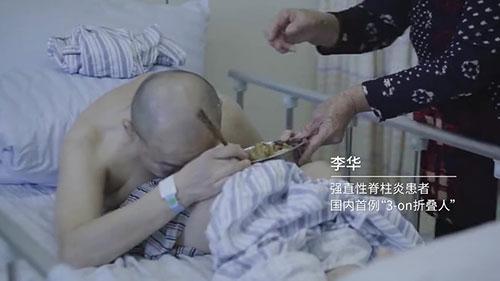 身體被敲斷4次的折疊人出院，打開(kāi)折疊人生(圖2)