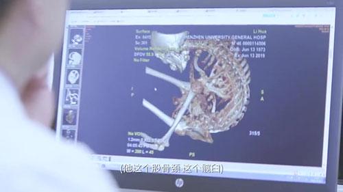 身體被敲斷4次的折疊人出院，打開(kāi)折疊人生(圖6)