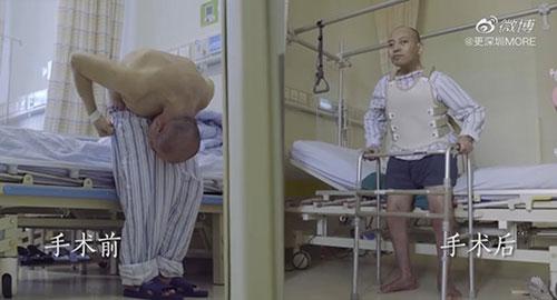 身體被敲斷4次的折疊人出院，打開(kāi)折疊人生(圖15)