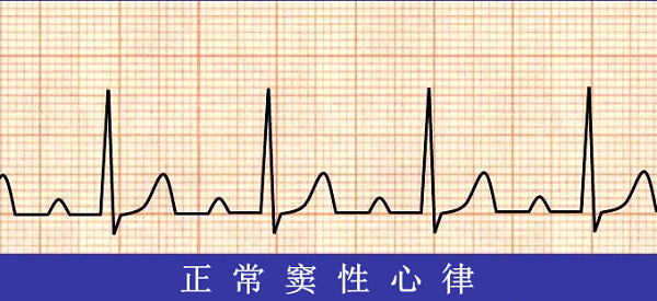 救命神器AED有多重要——你認(rèn)識(shí)它嗎？(圖6)